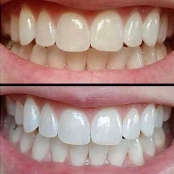 Whitening Toothpaste - Picture 3 of 16